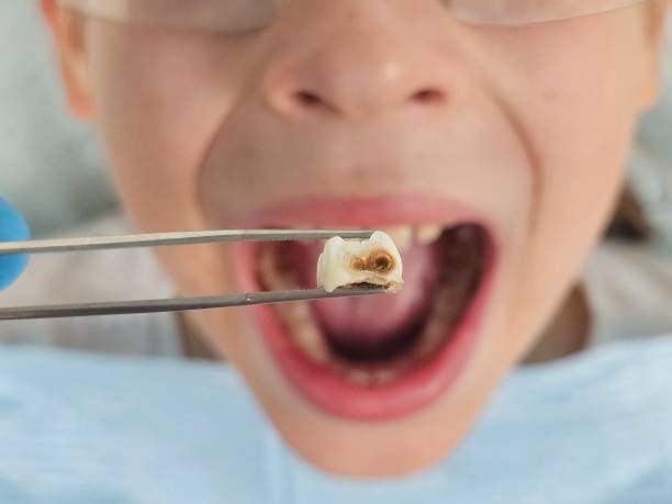 Best Pediatric Emergency Dentist in Battle Mountain, NV